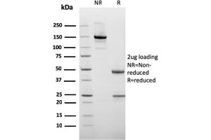 SDS-PAGE Analysis of Purified Cytokeratin 10 Mouse Recombinant Monoclonal Antibody (rKRT10/1275).