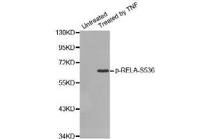 Western blot analysis of extracts from HepG2 cells using Phospho-RELA-S536 antibody (ABIN2987368). (NF-kB p65 antibody  (pSer536))