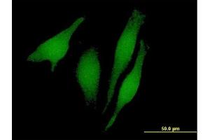 Immunofluorescence of purified MaxPab antibody to RUSC1 on HeLa cell. (RUSC1 antibody  (AA 1-433))