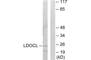 Western blot analysis of extracts from COLO205 cells, using LDOCL antibody. (LDOC1L antibody  (Internal Region))