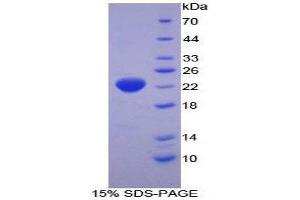 SDS-PAGE (SDS) image for Heat Shock 27kDa Protein 2 (HSPB2) (AA 12-182) protein (His tag) (ABIN1879279) (HSPB2 Protein (AA 12-182) (His tag))