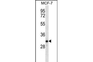 TESSP1 Antibody (Center) (ABIN656462 and ABIN2845746) western blot analysis in MCF-7 cell line lysates (35 μg/lane). (TESSP1 antibody  (AA 106-133))