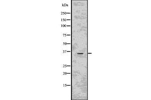 Western blot analysis of CD40LG using HepG2 whole  lysates. (CD40 Ligand antibody  (Internal Region))