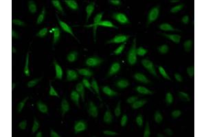 Immunofluorescence staining of Hela Cells with ABIN7127474 at 1:50, counter-stained with DAPI.