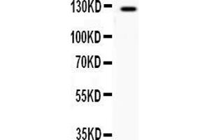 Western blot analysis of AFF44 expression in COLO320 whole cell lysates ( Lane 1). (AFF4 antibody  (N-Term))