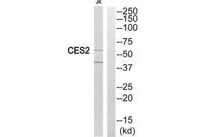 Western Blotting (WB) image for anti-Carboxylesterase 2 (CES2) (Internal Region) antibody (ABIN1851018) (CES2 antibody  (Internal Region))