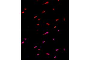Immunofluorescence analysis of PC-12 cells using EIF3J antibody (ABIN6127835, ABIN6140070, ABIN6140071 and ABIN6224734) at dilution of 1:100. (EIF3S1 antibody  (AA 1-258))