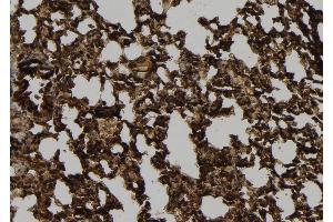 ABIN6272400 at 1/100 staining Mouse lung tissue by IHC-P. (POTE-14/22 antibody)