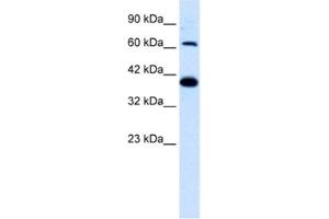 Western Blotting (WB) image for anti-Glutamate Receptor, Ionotropic, Kainate 2 (GRIK2) antibody (ABIN2461162) (GRIK2 antibody)