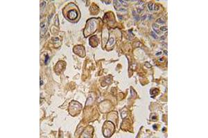 Image no. 1 for anti-Toll-Like Receptor 6 (TLR6) (C-Term) antibody (ABIN357055) (TLR6 antibody  (C-Term))