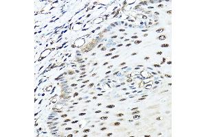 Immunohistochemistry of paraffin-embedded human esophageal using VCP Rabbit pAb (ABIN3016711, ABIN3016712, ABIN3016713 and ABIN6219823) at dilution of 1:100 (40x lens). (VCP antibody)