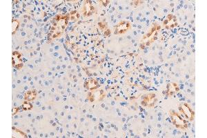 ABIN6267073 at 1/100 staining rat kidney tissue sections by IHC-P. (CHEK1 antibody  (pSer280))