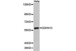 Western Blotting (WB) image for anti-Cyclin-Dependent Kinase Inhibitor 1C (p57, Kip2) (CDKN1C) antibody (ABIN1871758) (CDKN1C antibody)