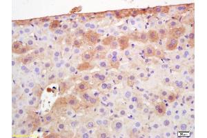 Formalin-fixed and paraffin embedded mouse liver labeled with Rabbit Anti Adiponectin Polyclonal Antibody, Unconjugated (ABIN669051) at 1:200 followed by conjugation to the secondary antibody and DAB staining (ADIPOQ antibody  (AA 151-244))