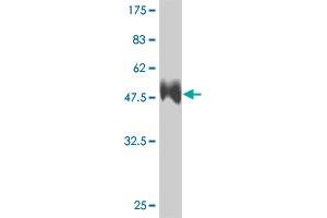 Western Blot detection against Immunogen (36. (RCAN1 antibody  (AA 1-100))