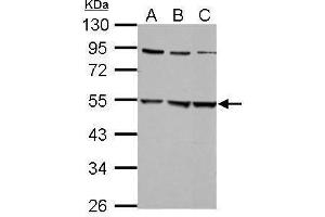 WB Image Sample (30 ug of whole cell lysate) A: 293T B: A431 C: HepG2 10% SDS PAGE antibody diluted at 1:5000 (GLRa2 antibody)