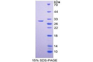 SDS-PAGE (SDS) image for GATA Binding Protein 1 (Globin Transcription Factor 1) (GATA1) (AA 20-265) protein (His tag) (ABIN2124930)