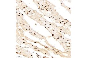 Immunohistochemistry of paraffin embedded rat heart using smad62024 (ABIN7075629) at dilution of 1:1000 (400x lens) (SMAD6 antibody)