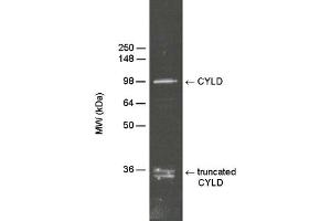 Detection of CYLD in HeLa S100 cytosolic fraction (, 10 μg) by Western blotting using PAb to CYLD (human)  at 1:5000 dilution. (CYLD antibody  (AA 336-353))