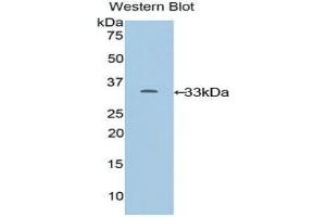 Western Blotting (WB) image for anti-Cytochrome P450, Family 24, Subfamily A, Polypeptide 1 (CYP24A1) (AA 260-514) antibody (ABIN1858590) (CYP24A1 antibody  (AA 260-514))