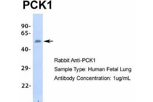 Host: Rabbit  Target Name: PCK1  Sample Tissue: Human Fetal Lung  Antibody Dilution: 1.