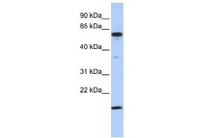 WB Suggested Anti-TRIAntibody Titration:  0. (TRIP10 antibody  (Middle Region))