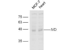 line1,MCF-7 lysates；line2,mouse heart lysate probed with Rabbit Anti-IVD Polyclonal Antibody, Unconjugated  at 1:5000 for 90min at 37˚C. (IVD antibody  (AA 201-300))