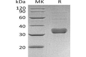 COLEC11 Protein (His tag)