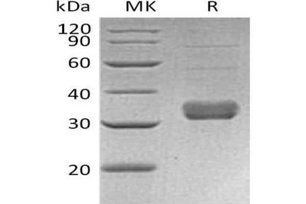 COLEC11 Protein (His tag)