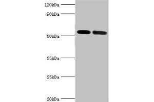 ATP6V1B1 antibody  (AA 1-280)