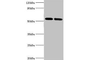 Western blot All lanes: V-type proton ATPase subunit B, kidney isoform antibody at 7 μg/mL Lane 1: Mouse kidney tissue Lane 2: 293T whole cell lysate Secondary Goat polyclonal to rabbit IgG at 1/10000 dilution Predicted band size: 57 kDa Observed band size: 57 kDa (ATP6V1B1 antibody  (AA 1-280))