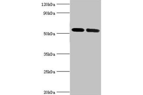 ATP6V1B1 抗体  (AA 1-280)