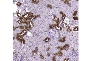 IHC testing of FFPE rat kidney tissue with CKB antibody at 1ug/ml. (CKB antibody)