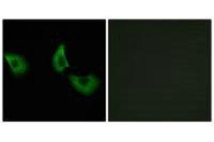 Immunofluorescence analysis of A549 cells, using EFEMP2 antibody. (FBLN4 antibody)
