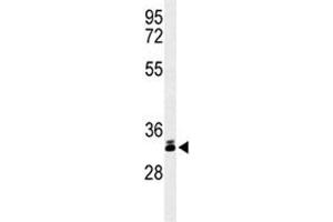 Western blot analysis of DKK-1 antibody and T47D lysate.