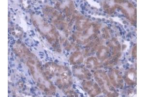 IHC-P analysis of Mouse Kidney Tissue, with DAB staining. (ACADS antibody  (AA 210-397))