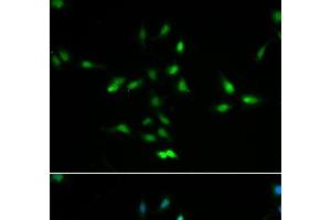 Immunofluorescence analysis of A549 cells using MDM2 Polyclonal Antibody (MDM2 antibody)