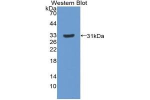 Western blot analysis of the recombinant protein. (Paxillin antibody  (AA 327-568))