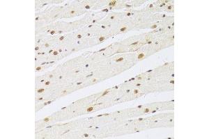 Immunohistochemistry of paraffin-embedded rat heart using MAPK3 Antibody. (ERK1 antibody  (AA 1-100))