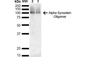 Western Blot analysis of Mouse, Rat Brain showing detection of 14 kDa Alpha Synuclein protein using Mouse Anti-Alpha Synuclein Monoclonal Antibody, Clone 3C11 (ABIN5564064). (SNCA antibody  (Biotin))