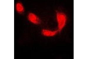 Immunofluorescent analysis of RBPJ staining in MCF7 cells. (RBPJ antibody)