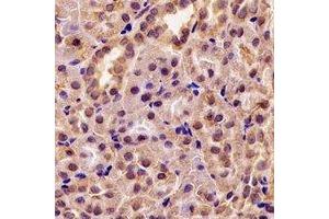 Immunohistochemical analysis of GRP75 staining in rat kidney formalin fixed paraffin embedded tissue section. (HSPA9 antibody)