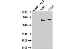 Immunoprecipitating MX1 in Hela whole cell lysate Lane 1: Rabbit control IgG instead of (1 μg) instead of ABIN7156641 in Hela whole cell lysate. (MX1 antibody  (AA 7-172))