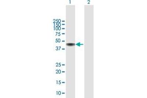 Western Blot analysis of CENPJ expression in transfected 293T cell line by CENPJ MaxPab polyclonal antibody.