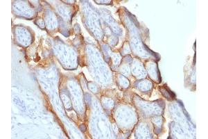 Formalin-fixed, paraffin-embedded human placenta stained with hCG beta Monoclonal Antibody (SPM529). (CGB antibody)