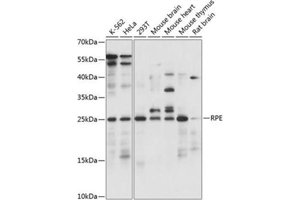 RPE antibody  (AA 1-228)