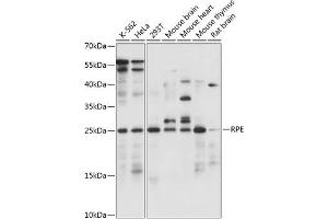 Western blot analysis of extracts of various cell lines, using RPE antibody (ABIN7270048) at 1:1000 dilution.
