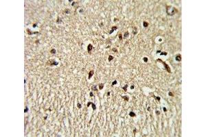 IHC analysis of FFPE human brain tissue stained with PAX4 antibody (PAX4 antibody  (AA 171-200))