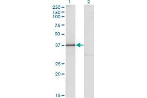 Western Blot analysis of DLX3 expression in transfected 293T cell line by DLX3 monoclonal antibody (M09), clone 3F7. (DLX3 antibody  (AA 1-287))