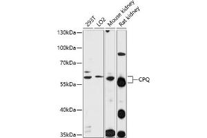 Western blot analysis of extracts of various cell lines, using CPQ antibody  at 1:1000 dilution. (CPQ antibody  (AA 1-100))